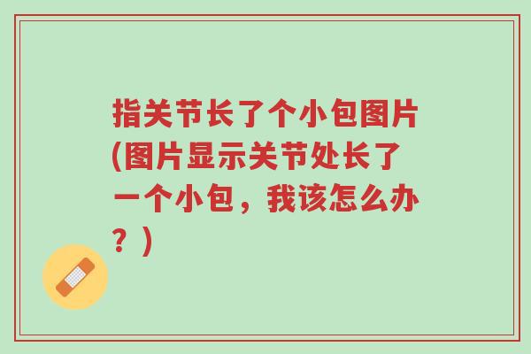 指关节长了个小包图片(图片显示关节处长了一个小包,我该怎么办?)-第1张图片-超越 指关节长了个小包图片(图片显示关节处长了一个小包,我该怎么办?)-第1张图片-超越