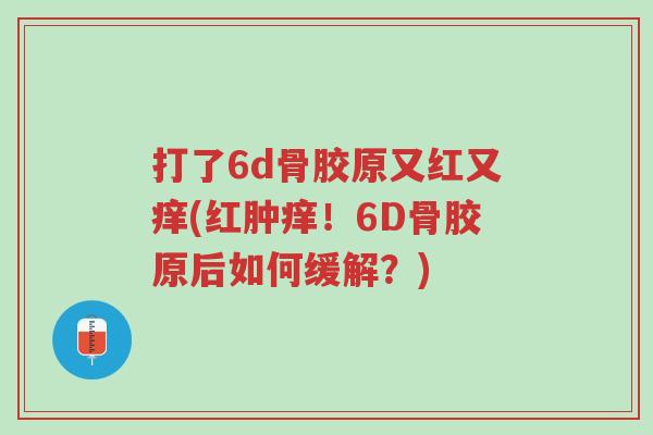 打了6d骨胶原又红又痒(红肿痒!6D骨胶原后如何缓解?)-第1张图片-超越 打了6d骨胶原又红又痒(红肿痒!6D骨胶原后如何缓解?)-第1张图片-超越