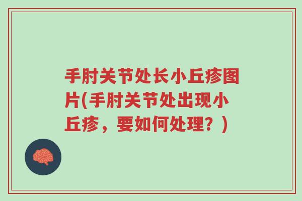 手肘关节处长小丘疹图片(手肘关节处出现小丘疹,要如何处理?)-第1张图片-超越 手肘关节处长小丘疹图片(手肘关节处出现小丘疹,要如何处理?)-第1张图片-超越