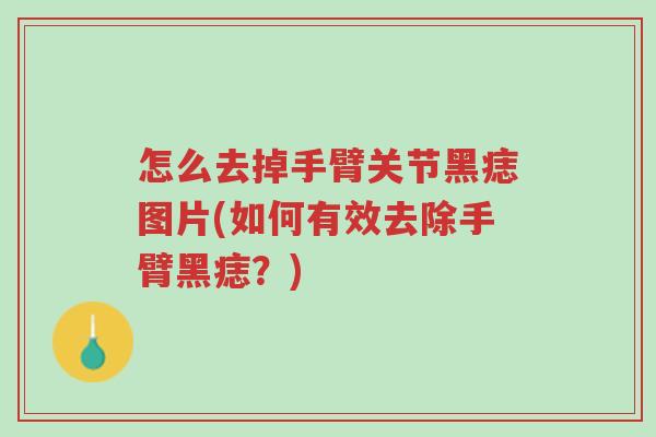 怎么去掉手臂关节黑痣图片(如何有效去除手臂黑痣?)-第1张图片-超越 怎么去掉手臂关节黑痣图片(如何有效去除手臂黑痣?)-第1张图片-超越