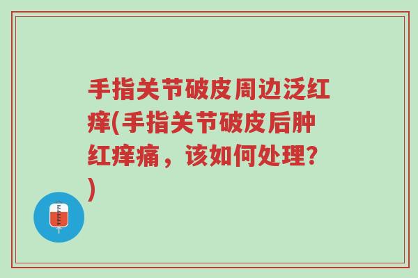 手指关节破皮周边泛红痒(手指关节破皮后肿红痒痛,该如何处理?)-第1张图片-超越 手指关节破皮周边泛红痒(手指关节破皮后肿红痒痛,该如何处理?)-第1张图片-超越