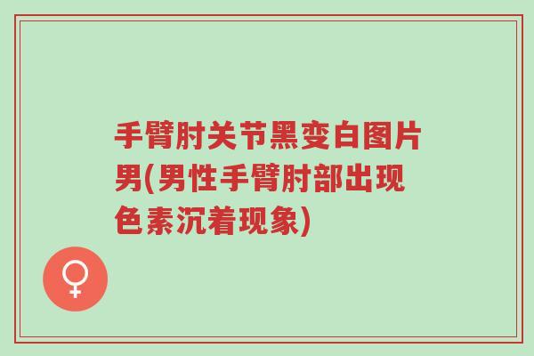 手臂肘关节黑变白图片男(男性手臂肘部出现色素沉着现象)-第1张图片-超越 手臂肘关节黑变白图片男(男性手臂肘部出现色素沉着现象)-第1张图片-超越