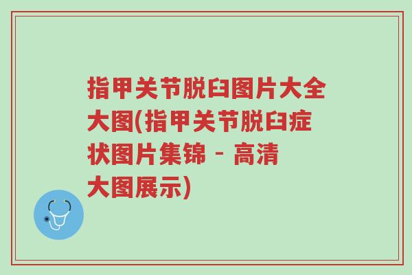 指甲关节脱臼图片大全大图(指甲关节脱臼症状图片集锦 - 高清大图展示)-第1张图片-超越 指甲关节脱臼图片大全大图(指甲关节脱臼症状图片集锦 - 高清大图展示)-第1张图片-超越