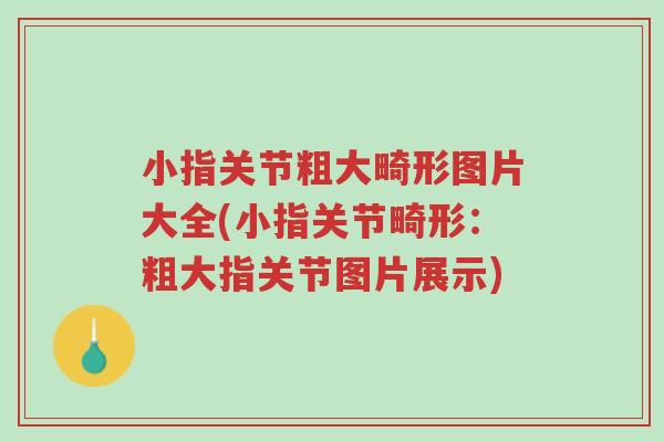 小指关节粗大畸形图片大全(小指关节畸形:粗大指关节图片展示)-第1张图片-超越 小指关节粗大畸形图片大全(小指关节畸形:粗大指关节图片展示)-第1张图片-超越
