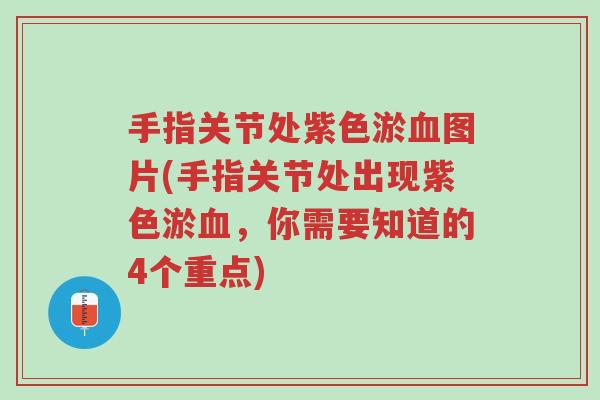 手指关节处紫色淤血图片(手指关节处出现紫色淤血，你需要知道的4个重点)-第1张图片-超越