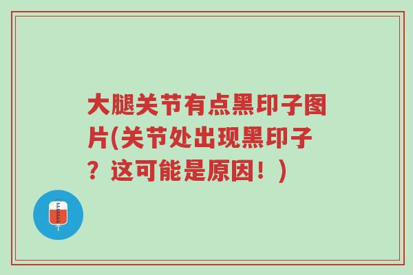 大腿关节有点黑印子图片(关节处出现黑印子？这可能是原因！)-第1张图片-超越