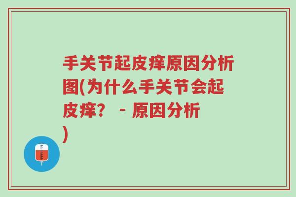 手关节起皮痒原因分析图(为什么手关节会起皮痒? - 原因分析)-第1张图片-超越 手关节起皮痒原因分析图(为什么手关节会起皮痒? - 原因分析)-第1张图片-超越