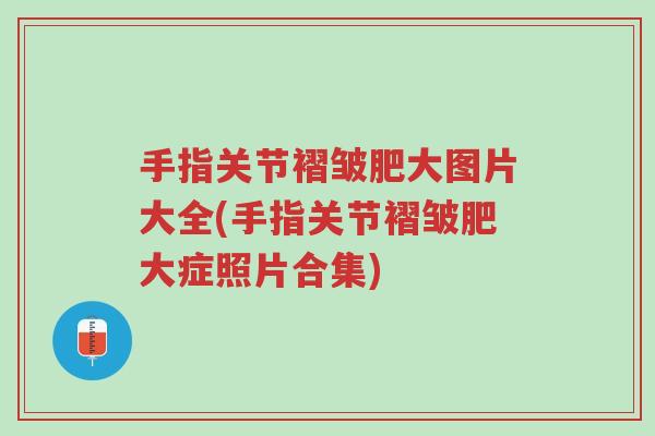 手指关节褶皱肥大图片大全(手指关节褶皱肥大症照片合集)-第1张图片-超越 手指关节褶皱肥大图片大全(手指关节褶皱肥大症照片合集)-第1张图片-超越