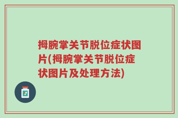 拇腕掌关节脱位症状图片(拇腕掌关节脱位症状图片及处理方法)-第1张图片-超越 拇腕掌关节脱位症状图片(拇腕掌关节脱位症状图片及处理方法)-第1张图片-超越