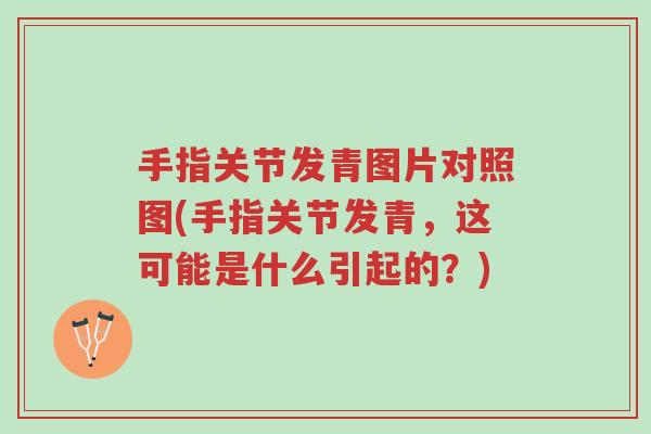 手指关节发青图片对照图(手指关节发青,这可能是什么引起的?)-第1张图片-超越 手指关节发青图片对照图(手指关节发青,这可能是什么引起的?)-第1张图片-超越