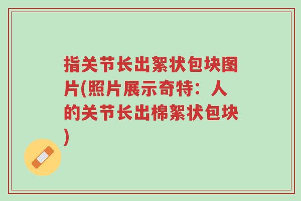 指关节长出絮状包块图片(照片展示奇特:人的关节长出棉絮状包块)-第1张图片-超越 指关节长出絮状包块图片(照片展示奇特:人的关节长出棉絮状包块)-第1张图片-超越