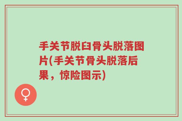 手关节脱臼骨头脱落图片(手关节骨头脱落后果,惊险图示)-第1张图片-超越 手关节脱臼骨头脱落图片(手关节骨头脱落后果,惊险图示)-第1张图片-超越