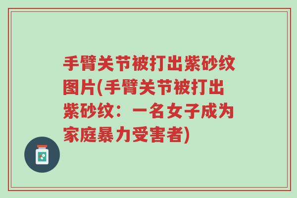 手臂关节被打出紫砂纹图片(手臂关节被打出紫砂纹：一名女子成为家庭暴力受害者)-第1张图片-超越