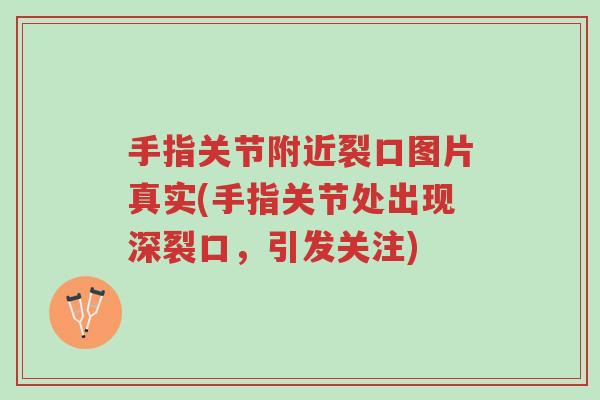 手指关节附近裂口图片真实(手指关节处出现深裂口,引发关注)-第1张图片-超越 手指关节附近裂口图片真实(手指关节处出现深裂口,引发关注)-第1张图片-超越