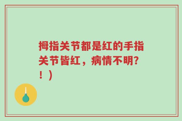 拇指关节都是红的手指关节皆红,病情不明?!)-第1张图片-超越 拇指关节都是红的手指关节皆红,病情不明?!)-第1张图片-超越