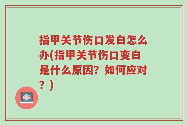 指甲关节伤口发白怎么办(指甲关节伤口变白是什么原因?如何应对?)-第1张图片-超越 指甲关节伤口发白怎么办(指甲关节伤口变白是什么原因?如何应对?)-第1张图片-超越