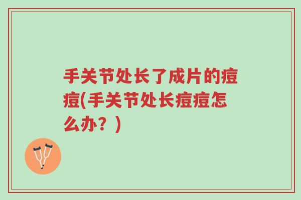 手关节处长了成片的痘痘(手关节处长痘痘怎么办?)-第1张图片-超越 手关节处长了成片的痘痘(手关节处长痘痘怎么办?)-第1张图片-超越