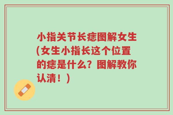 小指关节长痣图解女生(女生小指长这个位置的痣是什么?图解教你认清!)-第1张图片-超越 小指关节长痣图解女生(女生小指长这个位置的痣是什么?图解教你认清!)-第1张图片-超越