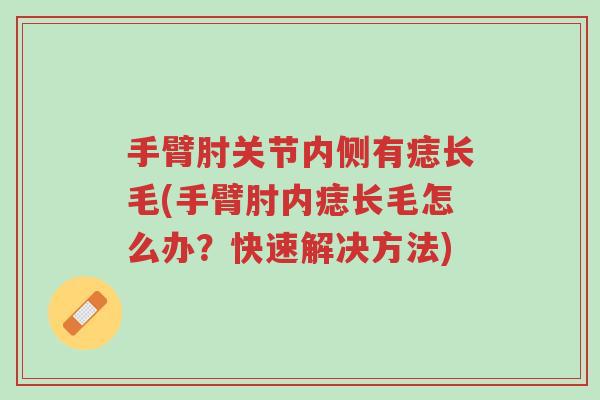 手臂肘关节内侧有痣长毛(手臂肘内痣长毛怎么办？快速解决方法)-第1张图片-超越