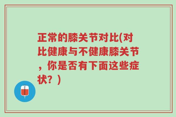正常的膝关节对比(对比健康与不健康膝关节,你是否有下面这些症状?)-第1张图片-超越 正常的膝关节对比(对比健康与不健康膝关节,你是否有下面这些症状?)-第1张图片-超越