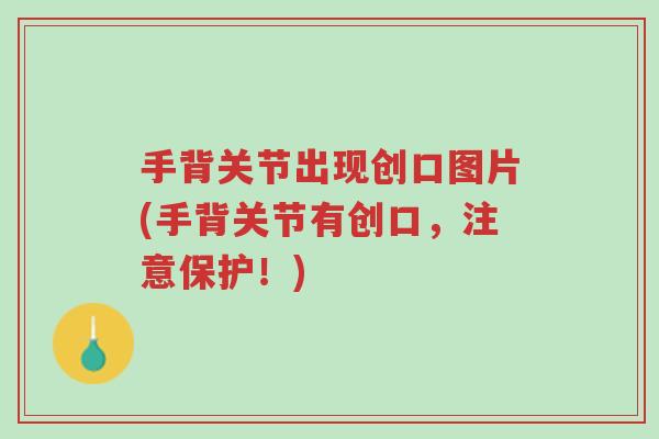 手背关节出现创口图片(手背关节有创口,注意保护!)-第1张图片-超越 手背关节出现创口图片(手背关节有创口,注意保护!)-第1张图片-超越