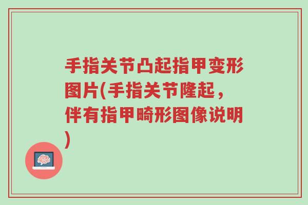 手指关节凸起指甲变形图片(手指关节隆起,伴有指甲畸形图像说明)-第1张图片-超越 手指关节凸起指甲变形图片(手指关节隆起,伴有指甲畸形图像说明)-第1张图片-超越
