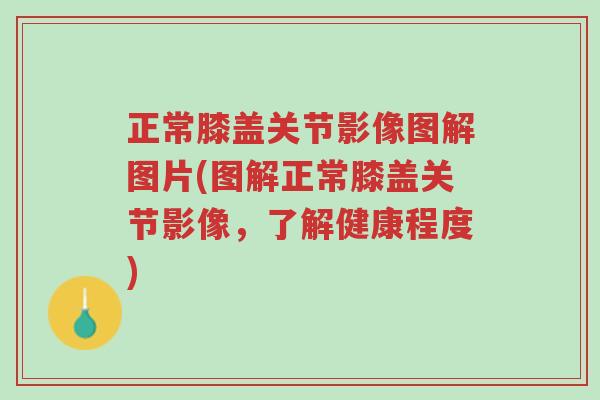 正常膝盖关节影像图解图片(图解正常膝盖关节影像,了解健康程度)-第1张图片-超越 正常膝盖关节影像图解图片(图解正常膝盖关节影像,了解健康程度)-第1张图片-超越
