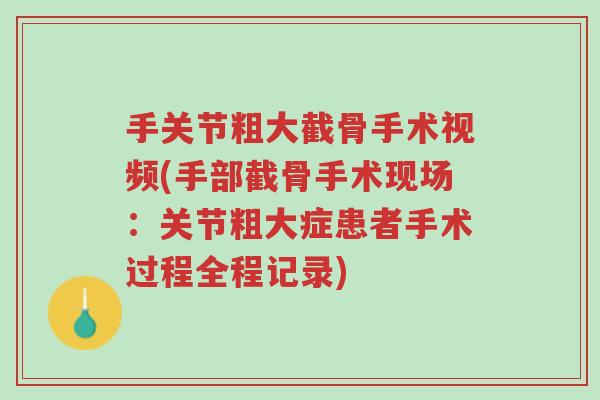 手关节粗大截骨手术视频(手部截骨手术现场:关节粗大症患者手术过程全程记录)-第1张图片-超越 手关节粗大截骨手术视频(手部截骨手术现场:关节粗大症患者手术过程全程记录)-第1张图片-超越