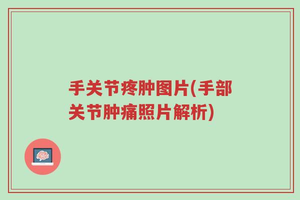 手关节疼肿图片(手部关节肿痛照片解析)-第1张图片-超越 手关节疼肿图片(手部关节肿痛照片解析)-第1张图片-超越