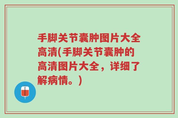 手脚关节囊肿图片大全高清(手脚关节囊肿的高清图片大全,详细了解病情。)-第1张图片-超越 手脚关节囊肿图片大全高清(手脚关节囊肿的高清图片大全,详细了解病情。)-第1张图片-超越