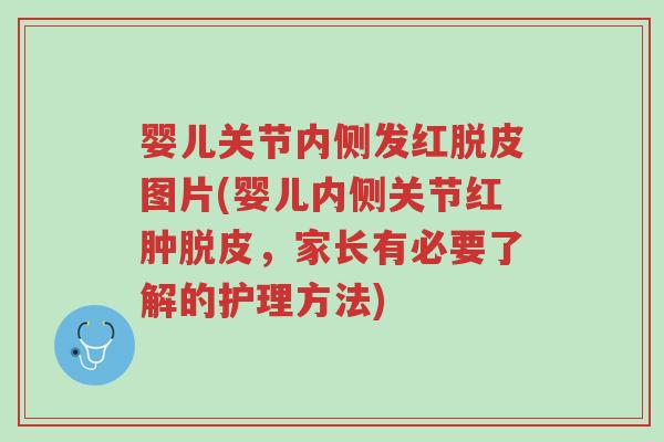 婴儿关节内侧发红脱皮图片(婴儿内侧关节红肿脱皮,家长有必要了解的护理方法)-第1张图片-超越 婴儿关节内侧发红脱皮图片(婴儿内侧关节红肿脱皮,家长有必要了解的护理方法)-第1张图片-超越