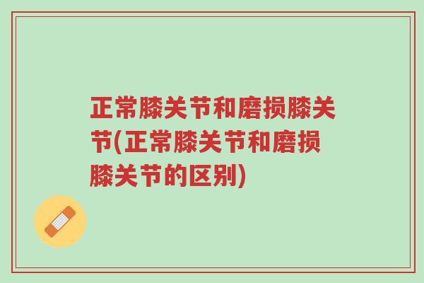 正常膝关节和磨损膝关节(正常膝关节和磨损膝关节的区别)-第1张图片-超越 正常膝关节和磨损膝关节(正常膝关节和磨损膝关节的区别)-第1张图片-超越