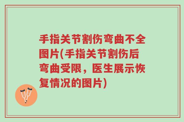 手指关节割伤弯曲不全图片(手指关节割伤后弯曲受限,医生展示恢复情况的图片)-第1张图片-超越 手指关节割伤弯曲不全图片(手指关节割伤后弯曲受限,医生展示恢复情况的图片)-第1张图片-超越