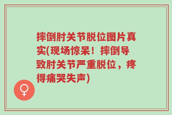 摔倒肘关节脱位图片真实(现场惊呆!摔倒导致肘关节严重脱位,疼得痛哭失声)-第1张图片-超越 摔倒肘关节脱位图片真实(现场惊呆!摔倒导致肘关节严重脱位,疼得痛哭失声)-第1张图片-超越