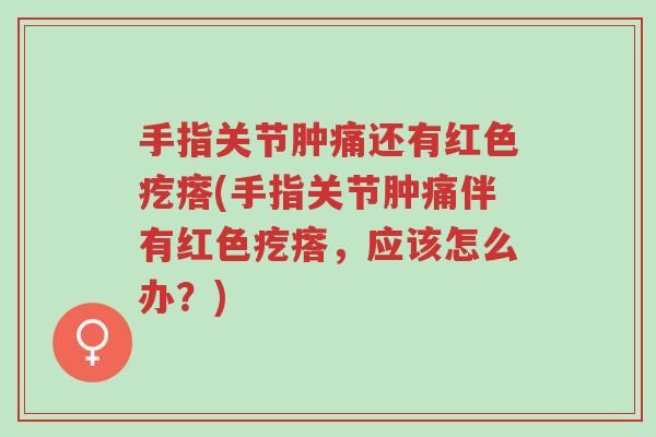 手指关节肿痛还有红色疙瘩(手指关节肿痛伴有红色疙瘩,应该怎么办?)-第1张图片-超越 手指关节肿痛还有红色疙瘩(手指关节肿痛伴有红色疙瘩,应该怎么办?)-第1张图片-超越