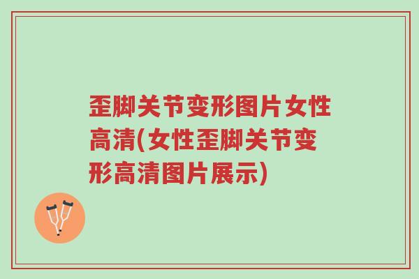 歪脚关节变形图片女性高清(女性歪脚关节变形高清图片展示)-第1张图片-超越 歪脚关节变形图片女性高清(女性歪脚关节变形高清图片展示)-第1张图片-超越