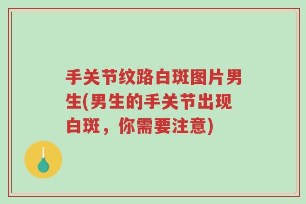 手关节纹路白斑图片男生(男生的手关节出现白斑,你需要注意)-第1张图片-超越 手关节纹路白斑图片男生(男生的手关节出现白斑,你需要注意)-第1张图片-超越