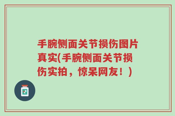 手腕侧面关节损伤图片真实(手腕侧面关节损伤实拍,惊呆网友!)-第1张图片-超越 手腕侧面关节损伤图片真实(手腕侧面关节损伤实拍,惊呆网友!)-第1张图片-超越