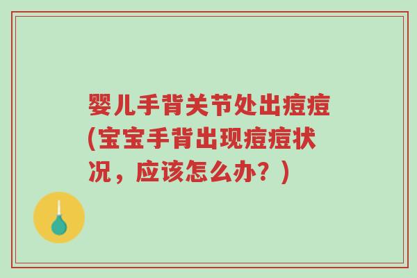 婴儿手背关节处出痘痘(宝宝手背出现痘痘状况,应该怎么办?)-第1张图片-超越 婴儿手背关节处出痘痘(宝宝手背出现痘痘状况,应该怎么办?)-第1张图片-超越
