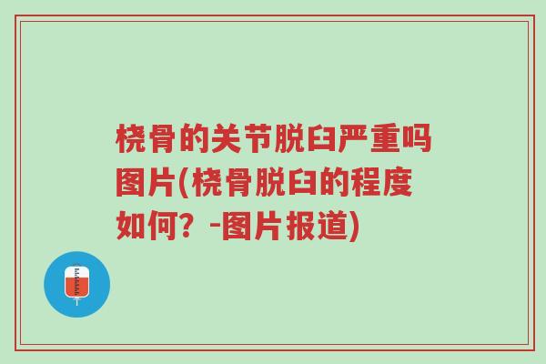 桡骨的关节脱臼严重吗图片(桡骨脱臼的程度如何?-图片报道)-第1张图片-超越 桡骨的关节脱臼严重吗图片(桡骨脱臼的程度如何?-图片报道)-第1张图片-超越
