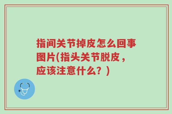 指间关节掉皮怎么回事图片(指头关节脱皮,应该注意什么?)-第1张图片-超越 指间关节掉皮怎么回事图片(指头关节脱皮,应该注意什么?)-第1张图片-超越