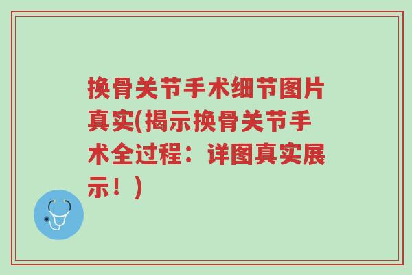 换骨关节手术细节图片真实(揭示换骨关节手术全过程:详图真实展示!)-第1张图片-超越 换骨关节手术细节图片真实(揭示换骨关节手术全过程:详图真实展示!)-第1张图片-超越