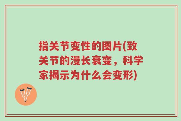 指关节变性的图片(致关节的漫长衰变,科学家揭示为什么会变形)-第1张图片-超越 指关节变性的图片(致关节的漫长衰变,科学家揭示为什么会变形)-第1张图片-超越