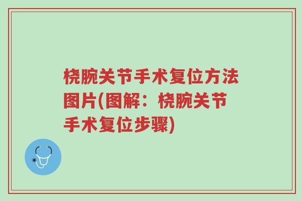 桡腕关节手术复位方法图片(图解:桡腕关节手术复位步骤)-第1张图片-超越 桡腕关节手术复位方法图片(图解:桡腕关节手术复位步骤)-第1张图片-超越