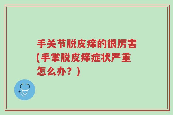 手关节脱皮痒的很厉害(手掌脱皮痒症状严重怎么办?)-第1张图片-超越 手关节脱皮痒的很厉害(手掌脱皮痒症状严重怎么办?)-第1张图片-超越