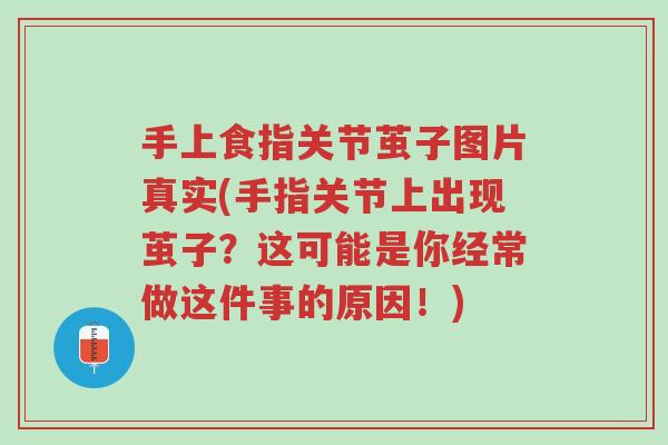 手上食指关节茧子图片真实(手指关节上出现茧子?这可能是你经常做这件事的原因!)-第1张图片-超越 手上食指关节茧子图片真实(手指关节上出现茧子?这可能是你经常做这件事的原因!)-第1张图片-超越