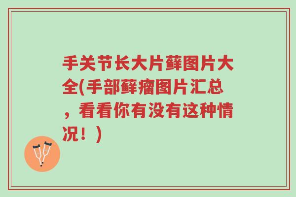 手关节长大片藓图片大全(手部藓瘤图片汇总,看看你有没有这种情况!)-第1张图片-超越 手关节长大片藓图片大全(手部藓瘤图片汇总,看看你有没有这种情况!)-第1张图片-超越