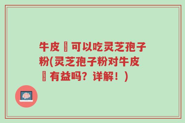 牛皮癬可以吃灵芝孢子粉(灵芝孢子粉对牛皮癬有益吗?详解!)-第1张图片-超越 牛皮癬可以吃灵芝孢子粉(灵芝孢子粉对牛皮癬有益吗?详解!)-第1张图片-超越