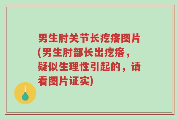 男生肘关节长疙瘩图片(男生肘部长出疙瘩,疑似生理性引起的,请看图片证实)-第1张图片-超越 男生肘关节长疙瘩图片(男生肘部长出疙瘩,疑似生理性引起的,请看图片证实)-第1张图片-超越