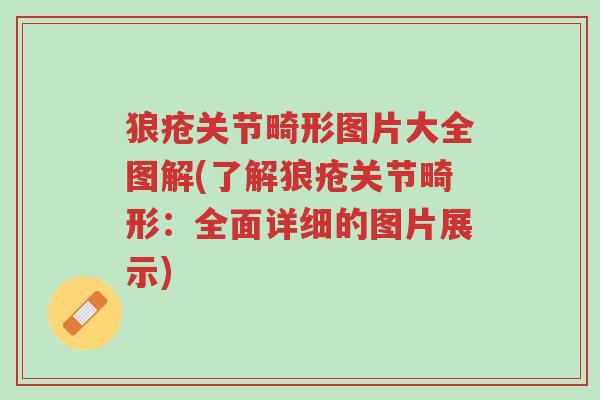 狼疮关节畸形图片大全图解(了解狼疮关节畸形:全面详细的图片展示)-第1张图片-超越 狼疮关节畸形图片大全图解(了解狼疮关节畸形:全面详细的图片展示)-第1张图片-超越